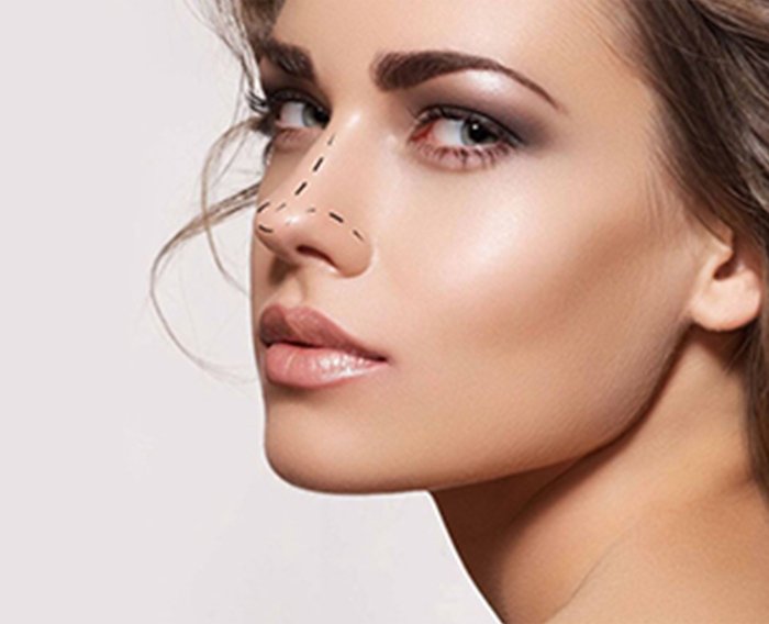 non surgical rhinoplasty