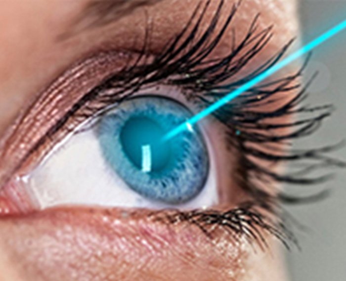 lasik eye surgeries